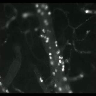 小鼠脑部炎症区域白细胞行为