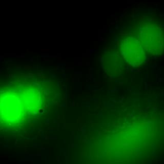 耳蜗听毛细胞钙离子成像