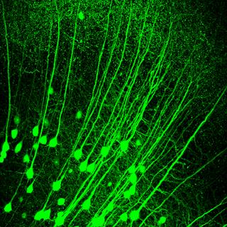 小鼠脑神经切片成像