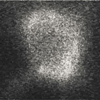 神经细胞膜电位变化的荧光成像