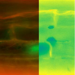 植物细胞钙应激