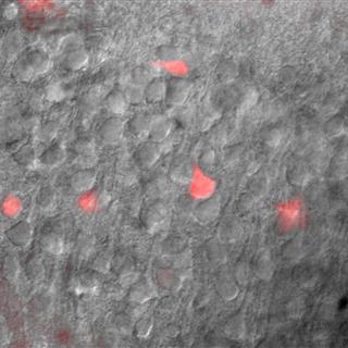 小鼠脑片IR-DIC/荧光成像