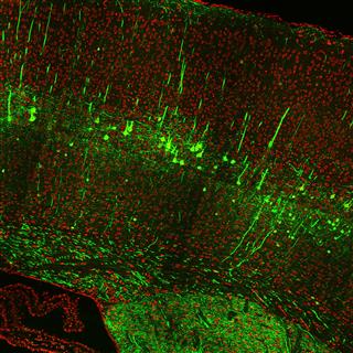 小鼠鼠脑冠状面神经元精细双色图