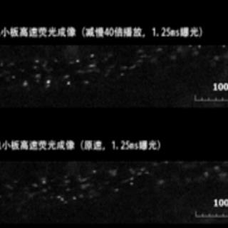 小鼠脑部血小板高速荧光成像