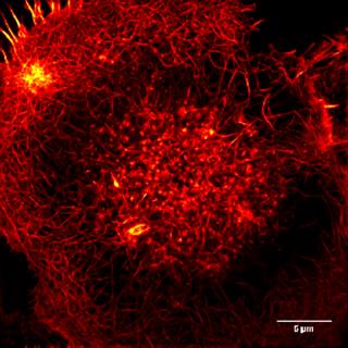 细胞微丝的动态变化