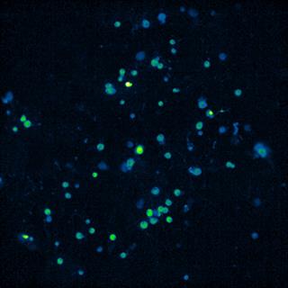 背根神经节神经元GCaMP钙离子成像