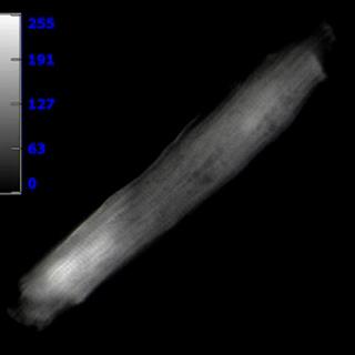 小鼠心肌细胞GCaMP钙波&钙火花成像