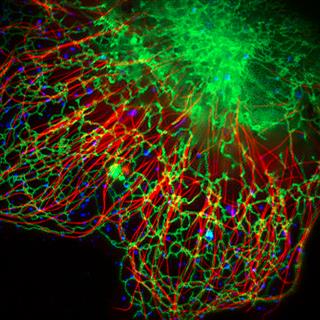 活细胞多色SIM超分辨