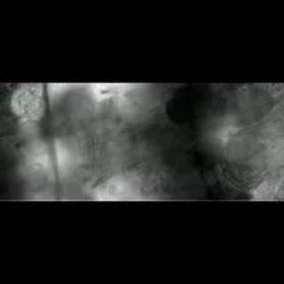 果蝇心脏管搏动