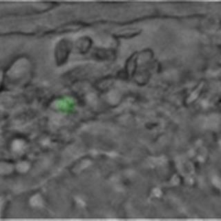 斑马鱼血液流动之荧光与明场DIC同步高速成像