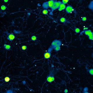 原代培养的背根神经节神经元