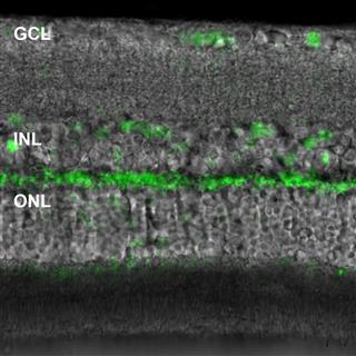 视网膜垂直切片成像