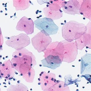 应对滨松数字病理切片扫描系统NanoZoomer细胞学图像模糊的操作建议