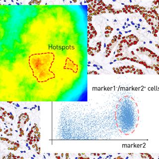 滨松数字病理软件分析实例：细胞核识别与分群