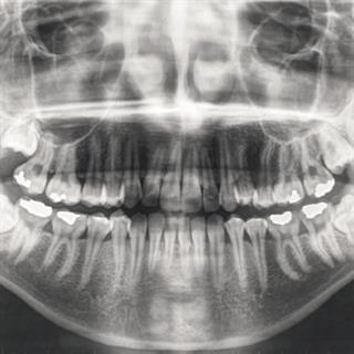 牙科影像