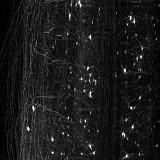 小鼠脊髓神经光片显微术成像