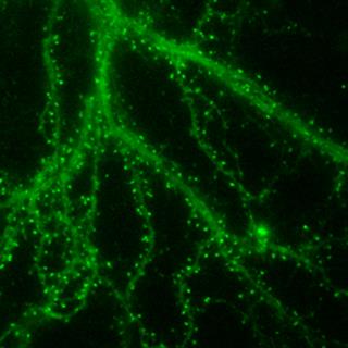 原代培养海马神经元树突