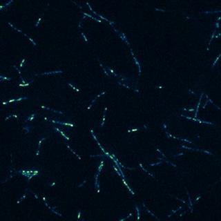 衣藻鞭毛中荧光蛋白转移的TIRF成像